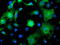 Spermine Synthase antibody, TA503098, Origene, Immunofluorescence image 
