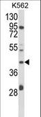 DHHB-MTase antibody, LS-C166948, Lifespan Biosciences, Western Blot image 