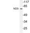 Mitochondrially Encoded NADH:Ubiquinone Oxidoreductase Core Subunit 5 antibody, LS-B13303, Lifespan Biosciences, Western Blot image 