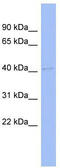 BTB Domain Containing 6 antibody, TA337271, Origene, Western Blot image 