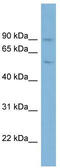 Plasminogen antibody, TA339213, Origene, Western Blot image 