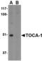 Formin Binding Protein 1 Like antibody, A06125, Boster Biological Technology, Western Blot image 
