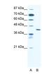 Zinc Finger Protein 621 antibody, NBP1-80005, Novus Biologicals, Western Blot image 