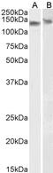 Damage Specific DNA Binding Protein 1 antibody, 45-048, ProSci, Enzyme Linked Immunosorbent Assay image 