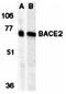 Myelin-oligodendrocyte glycoprotein antibody, orb18964, Biorbyt, Western Blot image 