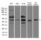 RAD52 Homolog, DNA Repair Protein antibody, LS-C796651, Lifespan Biosciences, Western Blot image 