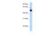 SS-A antibody, 28-828, ProSci, Enzyme Linked Immunosorbent Assay image 