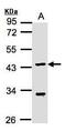 Kruppel Like Factor 15 antibody, GTX104839, GeneTex, Western Blot image 