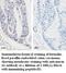 Mucin 16, Cell Surface Associated antibody, MBS416125, MyBioSource, Immunohistochemistry paraffin image 