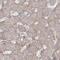 Leucine Rich Pentatricopeptide Repeat Containing antibody, PA5-57643, Invitrogen Antibodies, Immunohistochemistry paraffin image 