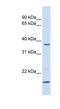 Zinc Finger DHHC-Type Containing 19 antibody, NBP1-59445, Novus Biologicals, Western Blot image 