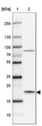 MYC Associated Factor X antibody, NBP1-88624, Novus Biologicals, Western Blot image 