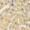 Kinesin Family Member 1B antibody, LS-C335694, Lifespan Biosciences, Immunohistochemistry paraffin image 