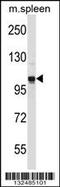 G Protein-Coupled Receptor Associated Sorting Protein 2 antibody, 56-872, ProSci, Western Blot image 