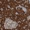 Centrosomal Protein 85 antibody, HPA028252, Atlas Antibodies, Immunohistochemistry paraffin image 