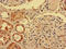 Immunoglobulin Heavy Constant Delta antibody, LS-C682202, Lifespan Biosciences, Immunohistochemistry paraffin image 