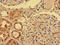 Ig delta chain C region antibody, LS-C682202, Lifespan Biosciences, Immunohistochemistry paraffin image 