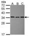 Exosome Component 3 antibody, GTX116123, GeneTex, Western Blot image 
