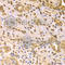 Mitogen-Activated Protein Kinase Kinase 7 antibody, A2186, ABclonal Technology, Immunohistochemistry paraffin image 