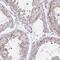 RAB6A, Member RAS Oncogene Family antibody, PA5-63663, Invitrogen Antibodies, Immunohistochemistry paraffin image 