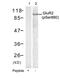 Glutamate Ionotropic Receptor AMPA Type Subunit 2 antibody, GTX50311, GeneTex, Western Blot image 