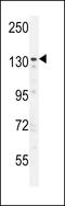 Zinc finger protein 536 antibody, LS-C160899, Lifespan Biosciences, Western Blot image 