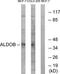 Aldolase, Fructose-Bisphosphate B antibody, TA311719, Origene, Western Blot image 