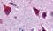 Ceramide Kinase antibody, PA5-32706, Invitrogen Antibodies, Immunohistochemistry paraffin image 