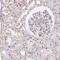 Zinc Finger Protein 224 antibody, NBP2-30794, Novus Biologicals, Immunohistochemistry paraffin image 