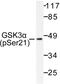 Glycogen Synthase Kinase 3 Alpha antibody, LS-C177904, Lifespan Biosciences, Western Blot image 