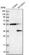 Solute Carrier Family 25 Member 11 antibody, NBP1-82490, Novus Biologicals, Western Blot image 