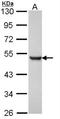 Presenilin 1 antibody, NBP1-33611, Novus Biologicals, Western Blot image 