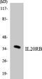 Interleukin-20 receptor subunit beta antibody, LS-C292098, Lifespan Biosciences, Western Blot image 