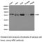 Autoimmune Regulator antibody, LS-C193029, Lifespan Biosciences, Western Blot image 