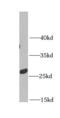 Metaxin 2 antibody, FNab05425, FineTest, Western Blot image 