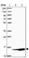 Small Nuclear Ribonucleoprotein D1 Polypeptide antibody, PA5-59206, Invitrogen Antibodies, Western Blot image 