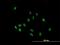 Immunoglobulin Heavy Constant Alpha 2 (A2m Marker) antibody, H00003494-B01P, Novus Biologicals, Immunofluorescence image 
