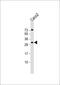 RAS Like Family 12 antibody, 59-651, ProSci, Western Blot image 