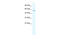 Potassium Voltage-Gated Channel Subfamily A Member 10 antibody, 28-252, ProSci, Western Blot image 