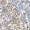 MutS Homolog 6 antibody, A0983, ABclonal Technology, Immunohistochemistry paraffin image 