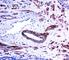 Angiotensin I Converting Enzyme antibody, R31318, NSJ Bioreagents, Western Blot image 