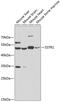 Somatostatin Receptor 1 antibody, GTX54732, GeneTex, Western Blot image 