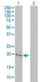 Cytoglobin antibody, LS-C105200, Lifespan Biosciences, Western Blot image 