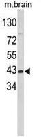 Glutamic-Oxaloacetic Transaminase 1 antibody, GTX81944, GeneTex, Western Blot image 