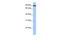 ADAM Metallopeptidase Domain 2 antibody, GTX45491, GeneTex, Western Blot image 