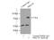 Protein Kinase C Beta antibody, 12919-1-AP, Proteintech Group, Immunoprecipitation image 