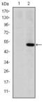 Matrix Metallopeptidase 1 antibody, GTX60467, GeneTex, Western Blot image 