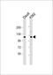 Signal Transducer And Activator Of Transcription 2 antibody, 58-173, ProSci, Western Blot image 