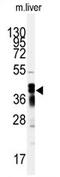 Aldo-Keto Reductase Family 7 Member A2 antibody, AP13849PU-N, Origene, Western Blot image 