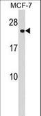 Charged multivesicular body protein 1a antibody, LS-C168737, Lifespan Biosciences, Western Blot image 